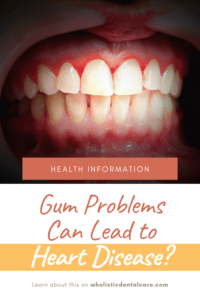Gum and Heart Problems